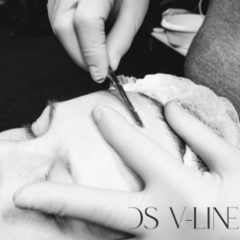 DS V-Line Dermaplaning
